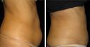Before & After Photos